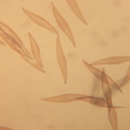 Kieselalge Aug 2025-P1550268 01